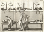 Aldini’s experiments applying electric current to corpses.