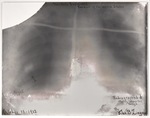 X-ray of Roosevelt's chest, showing the imbedded bullet. Edited to reduce image deterioration. Via Galter Special Collections.