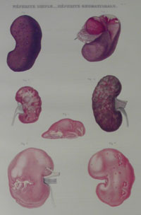 Pierre Francois Olive Rayer’s Traité